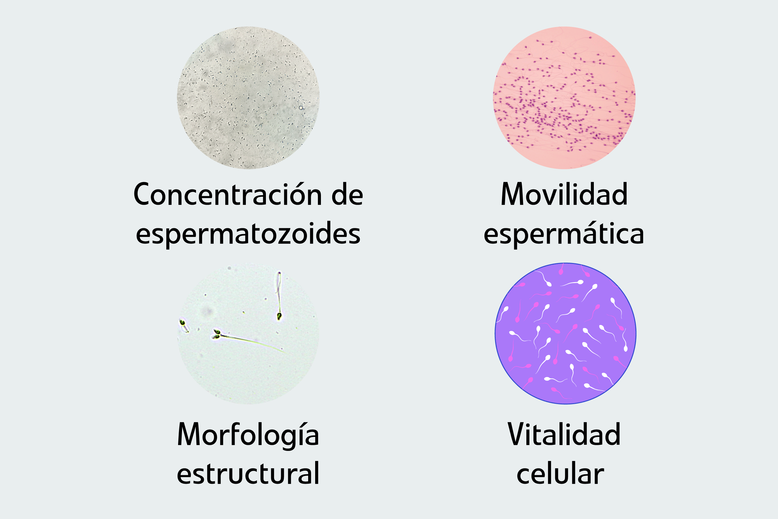 Estudio microscópico del semen